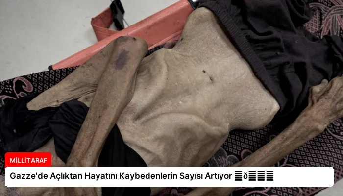 Gazze’de Açlıktan Hayatını Kaybedenlerin Sayısı Artıyor ⏬👇